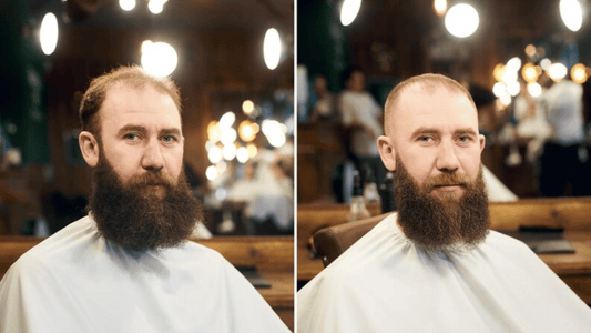 Beard oil benefits