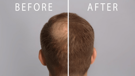 Hair loss consultation at Allan’s Men’s Hairdressing.